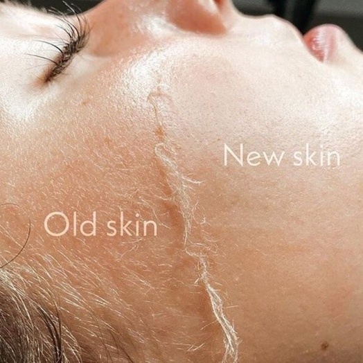 Dermaplaning plus Facial