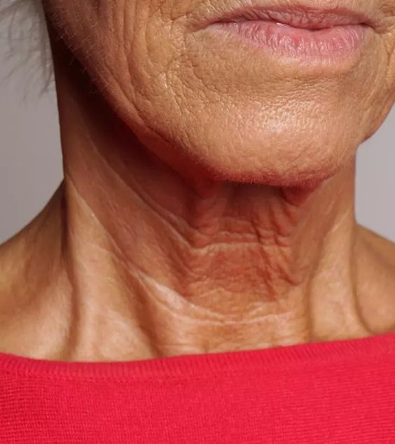 Youthful Skin