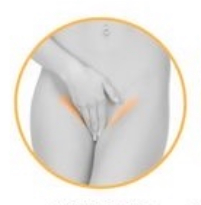 BIKINI LINE Laser Hair Removal