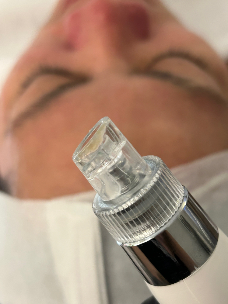 Hydroglow (Hydrodermabrasion)