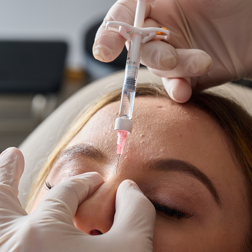 Liquid Rhinoplasty at The SkinLab Aesthetics in Houston, TX
