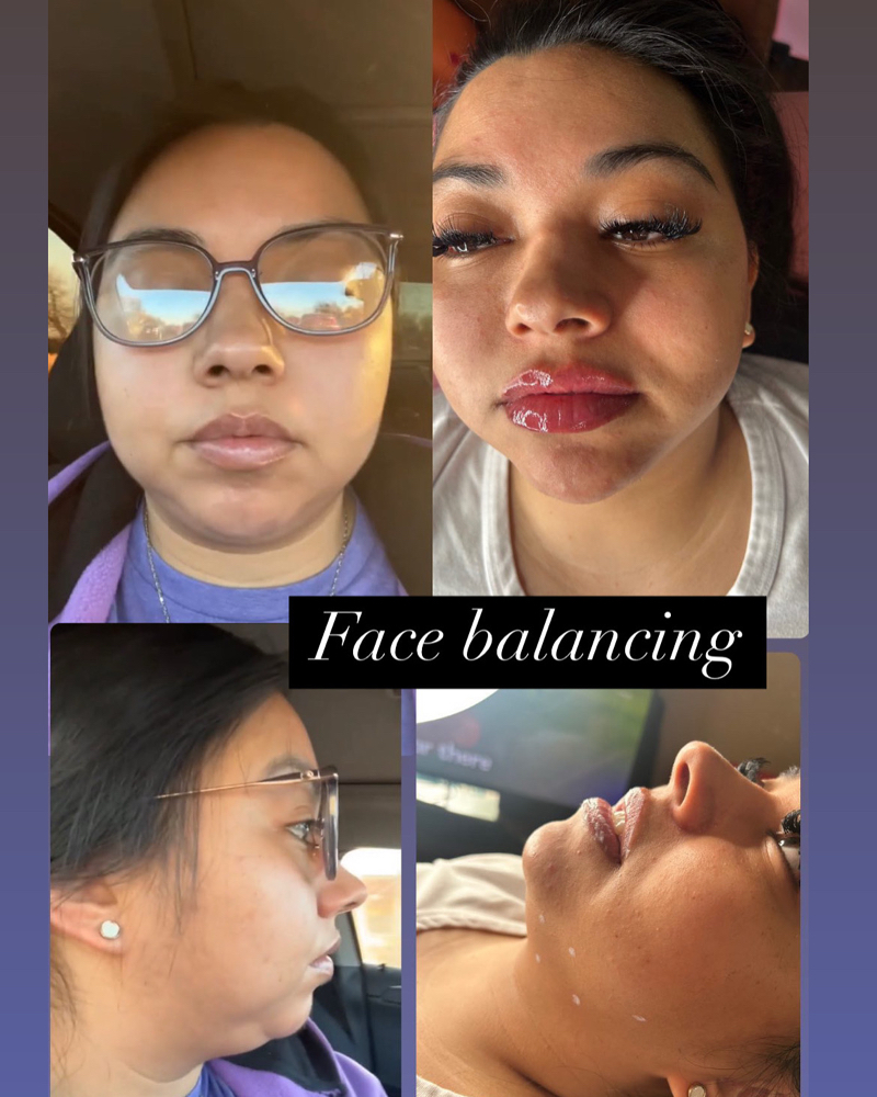 Full Face Blanacing