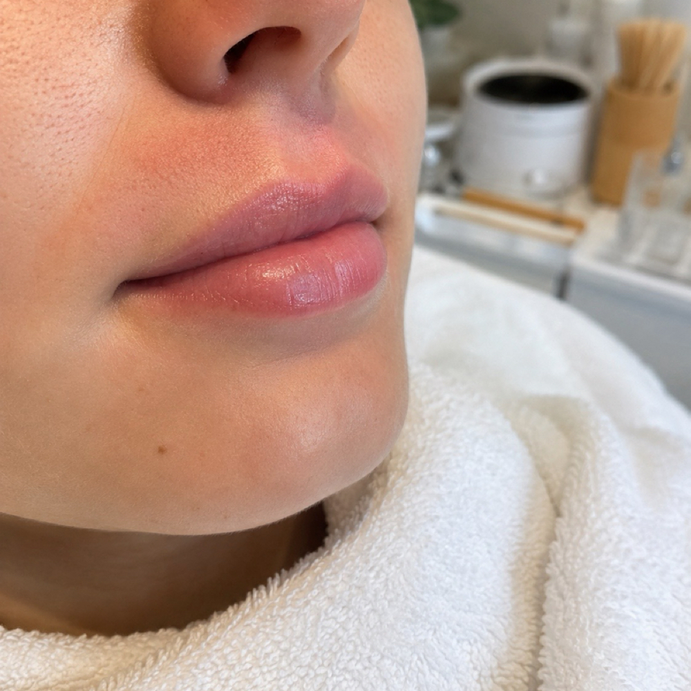 Lip Wax at HALO SKN ESTHETICS in Killeen, TX