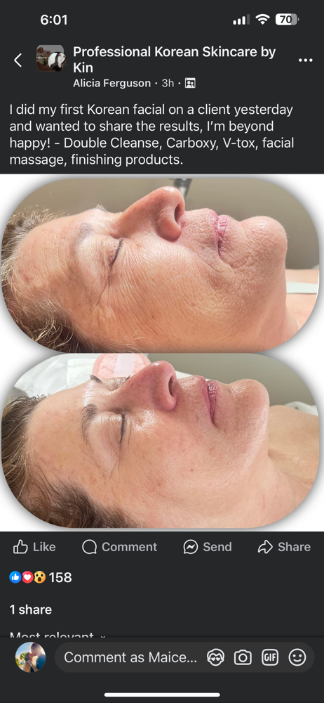 Better Than Botox Facial