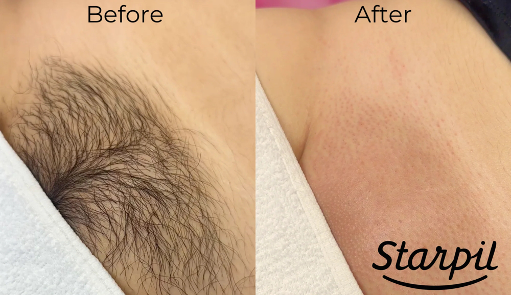 Full Brazilian C-B-D Wax