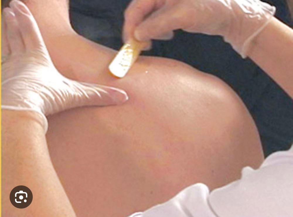 Shoulders at Eygptian Esthetics in Upper Marlboro, MD