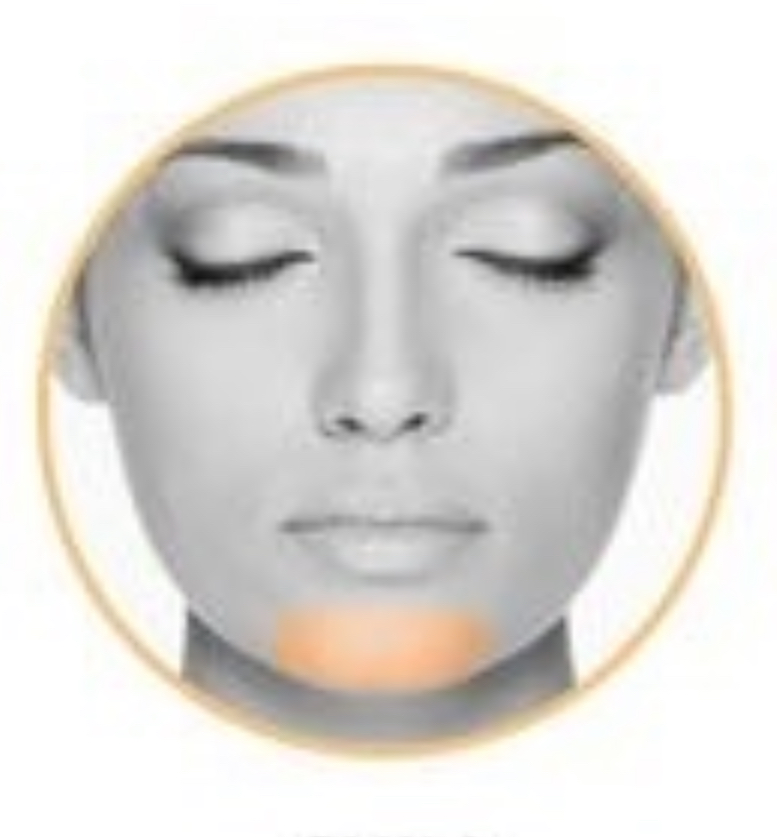 CHIN Laser Hair Removal