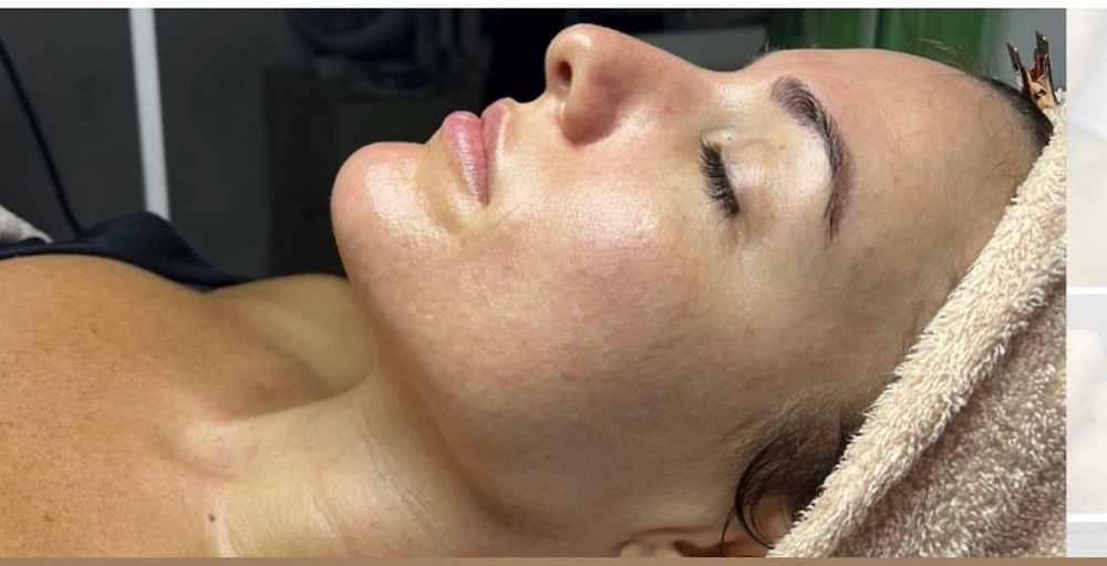 Slim And Sculpt Facial