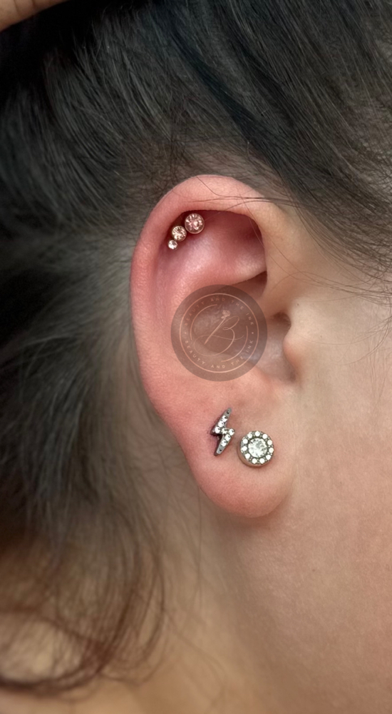 Upper Lobe (Jewelry Included IGT)