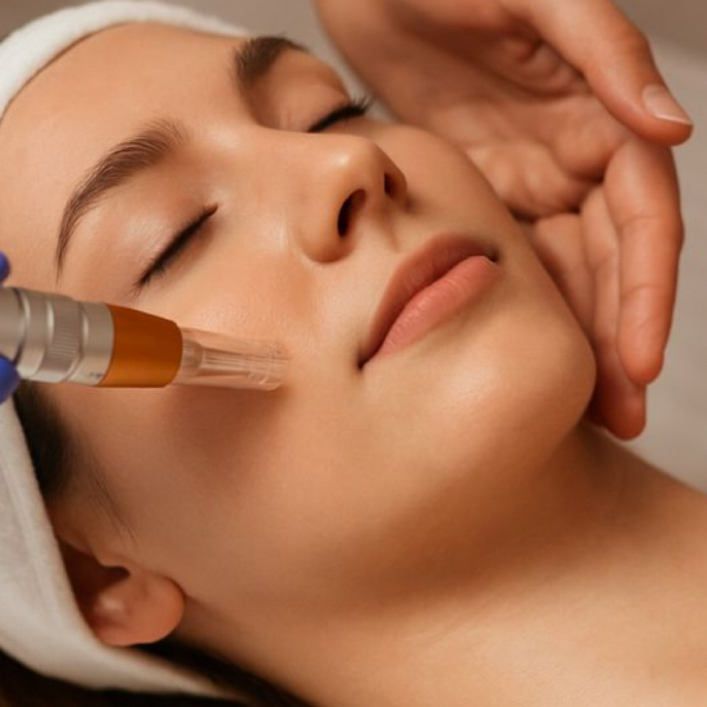 BOGO 50% off Nanoneedle Facial at Jolie Esthetics in Greenwood Village, CO