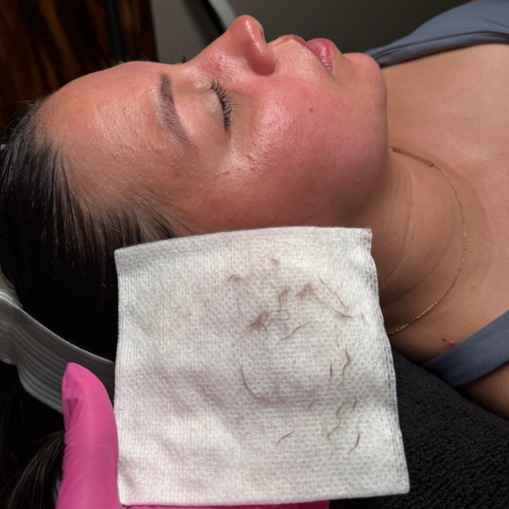 Dermaflash Facial at glowwithbreanna in Dayton, TX