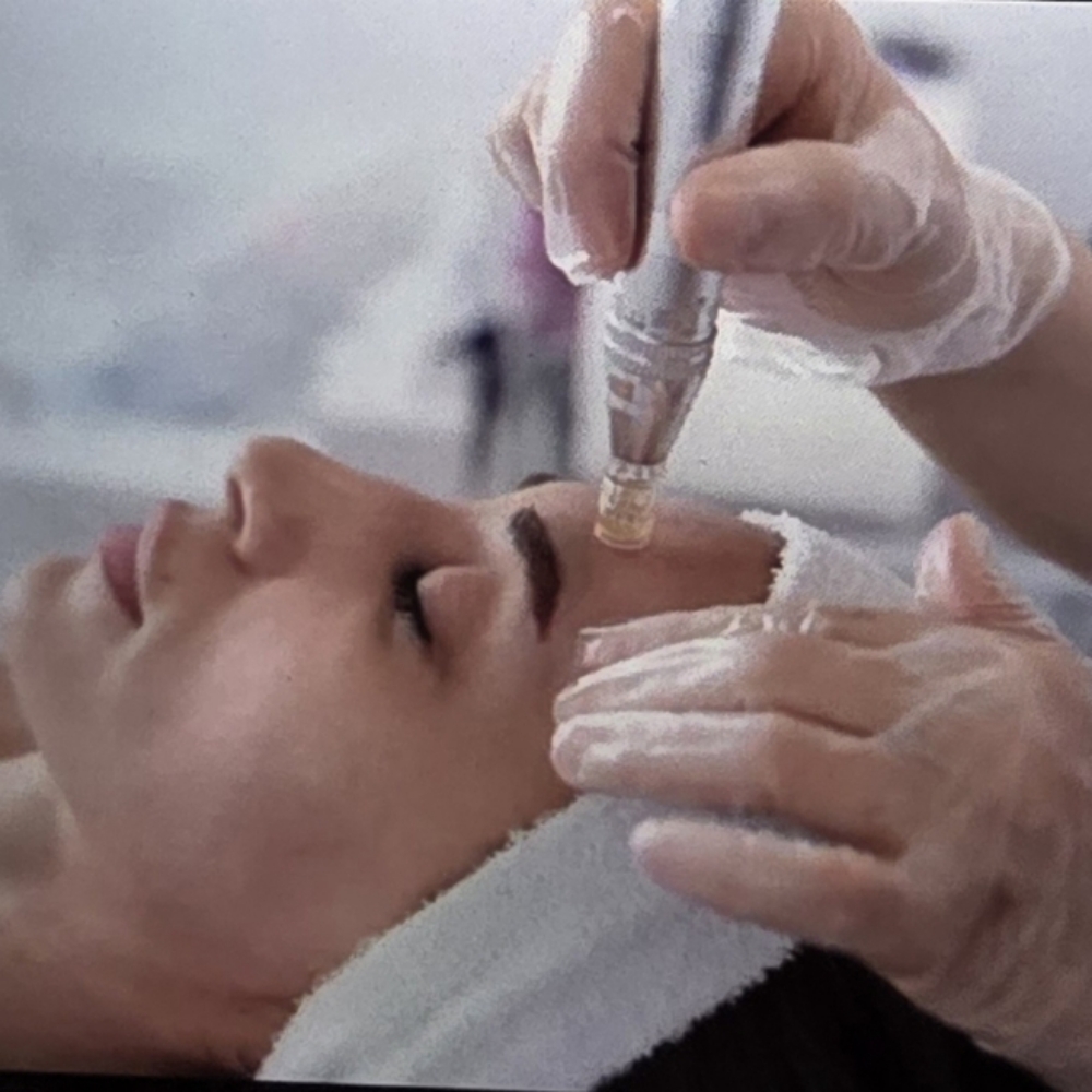 Nanoneedling at JULES COSMETIC ARTISTRY in Omaha, NE
