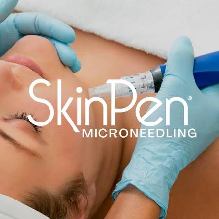 SkinPen Microneedling Treatment