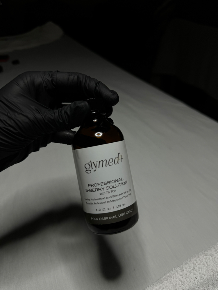 Custom Chemical Peel