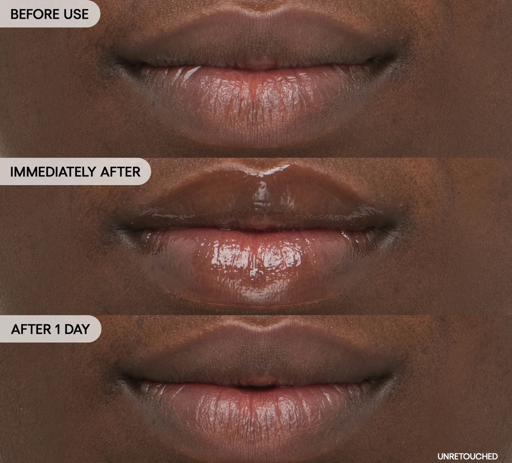Lip Treatment Add-On