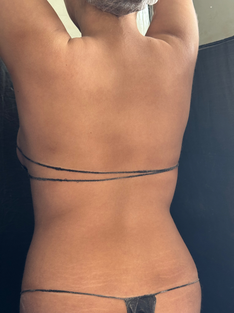 Spray Tan