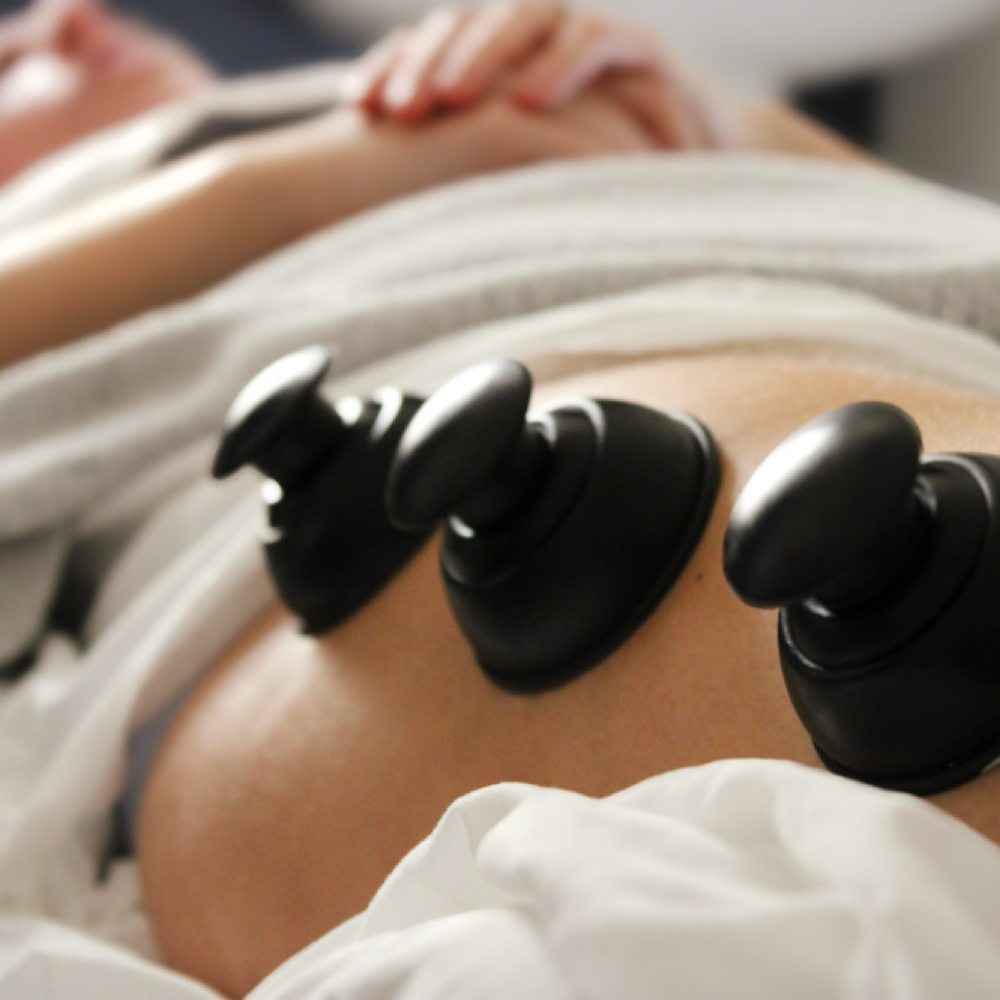 Cupping at Reverie Skin Lab in London, KY