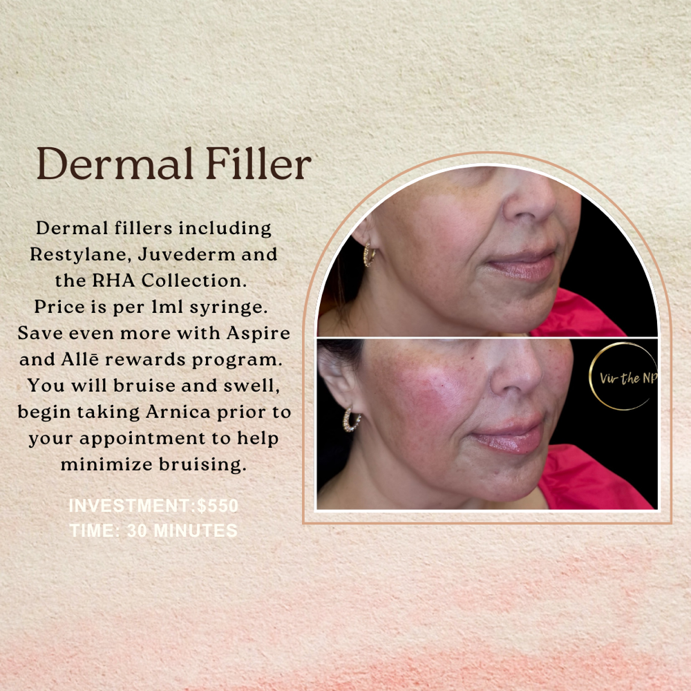 Dermal Fillers