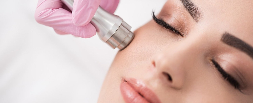 Microdermabrasion Facial