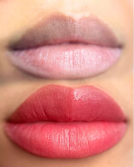 Lip Micropigmentation