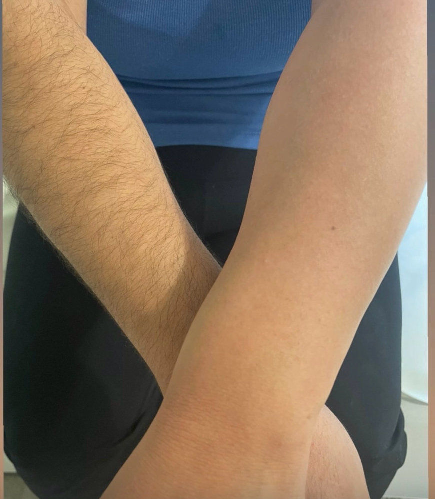 Half Arm Wax at Unveiled skin in Moreno Valley, CA