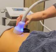 Cryo T Cellulite Reduction