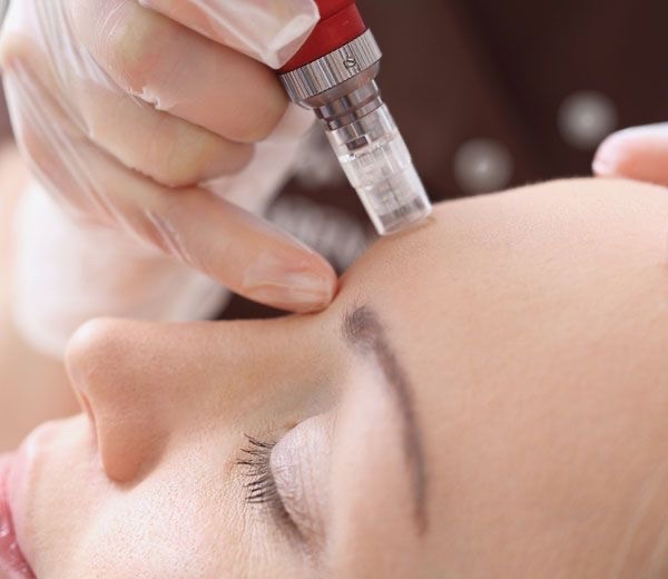 Skin Renewal Micro Channeling