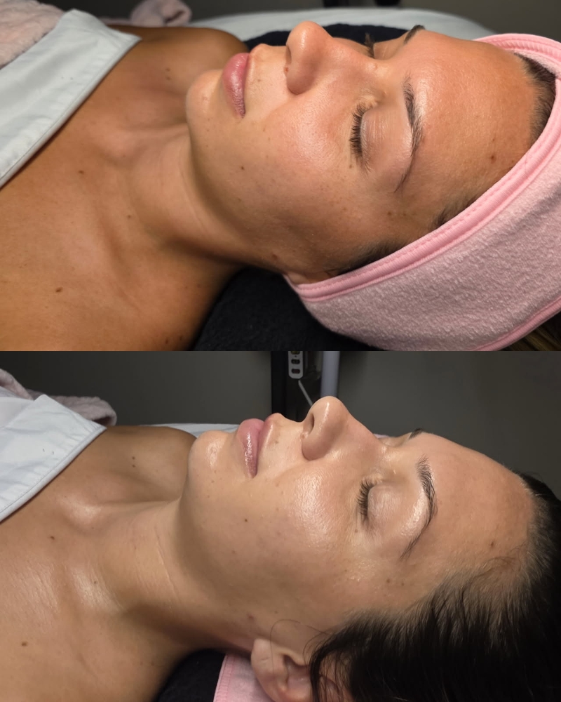 The Ultimate Skin Reset