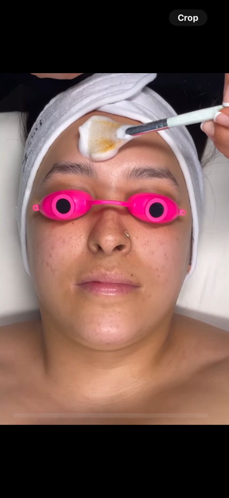 Clear Start Acne Facial