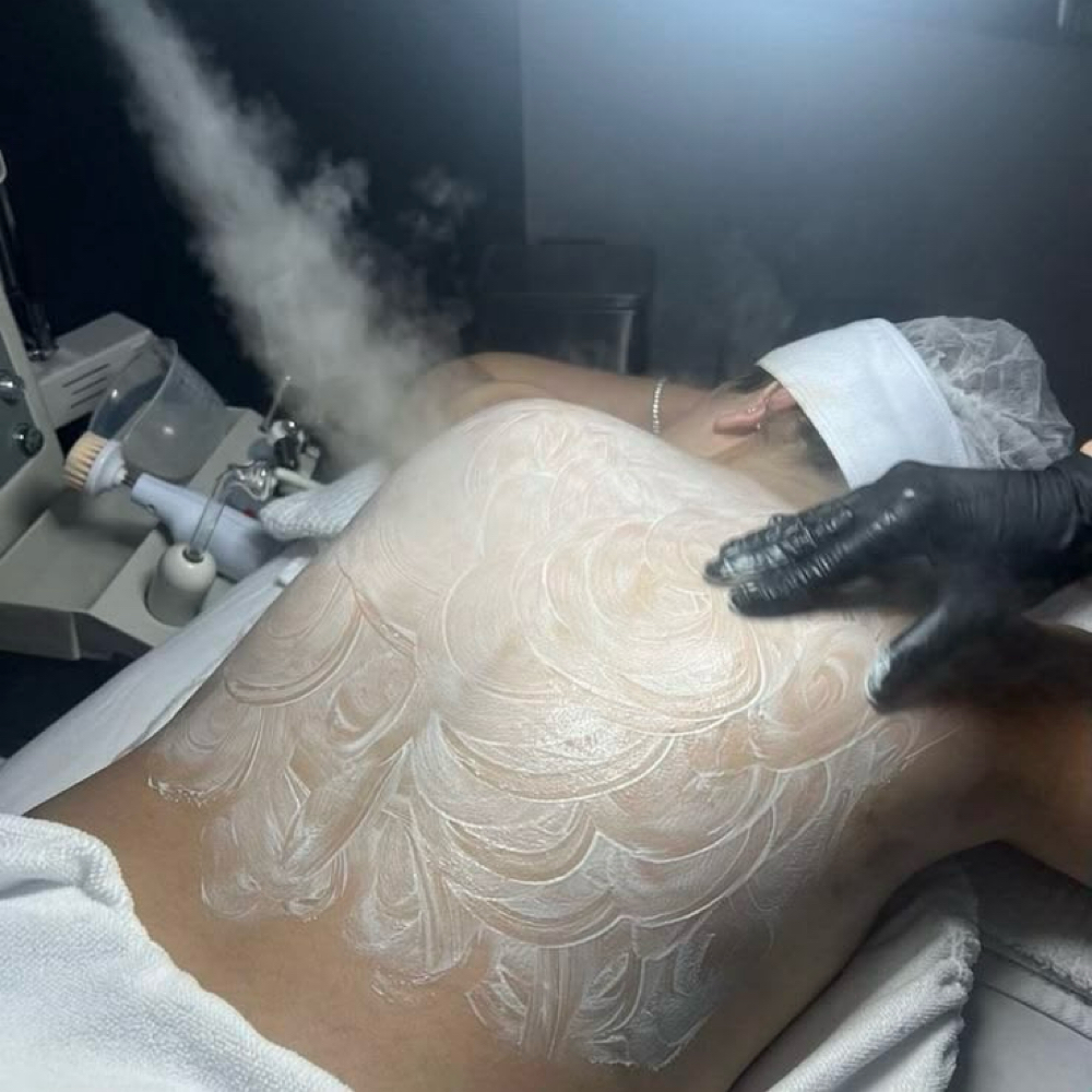Back Treatment at Wild Lily Esthetics in Richmond, KY