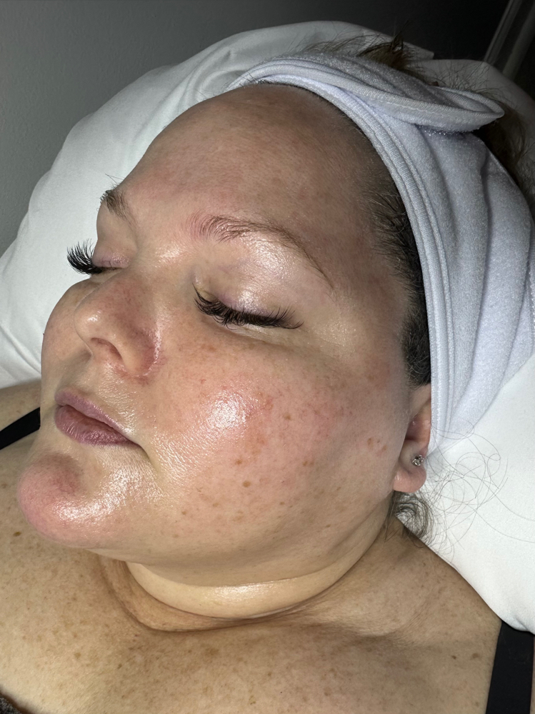 Deluxe Dermaplane Facial