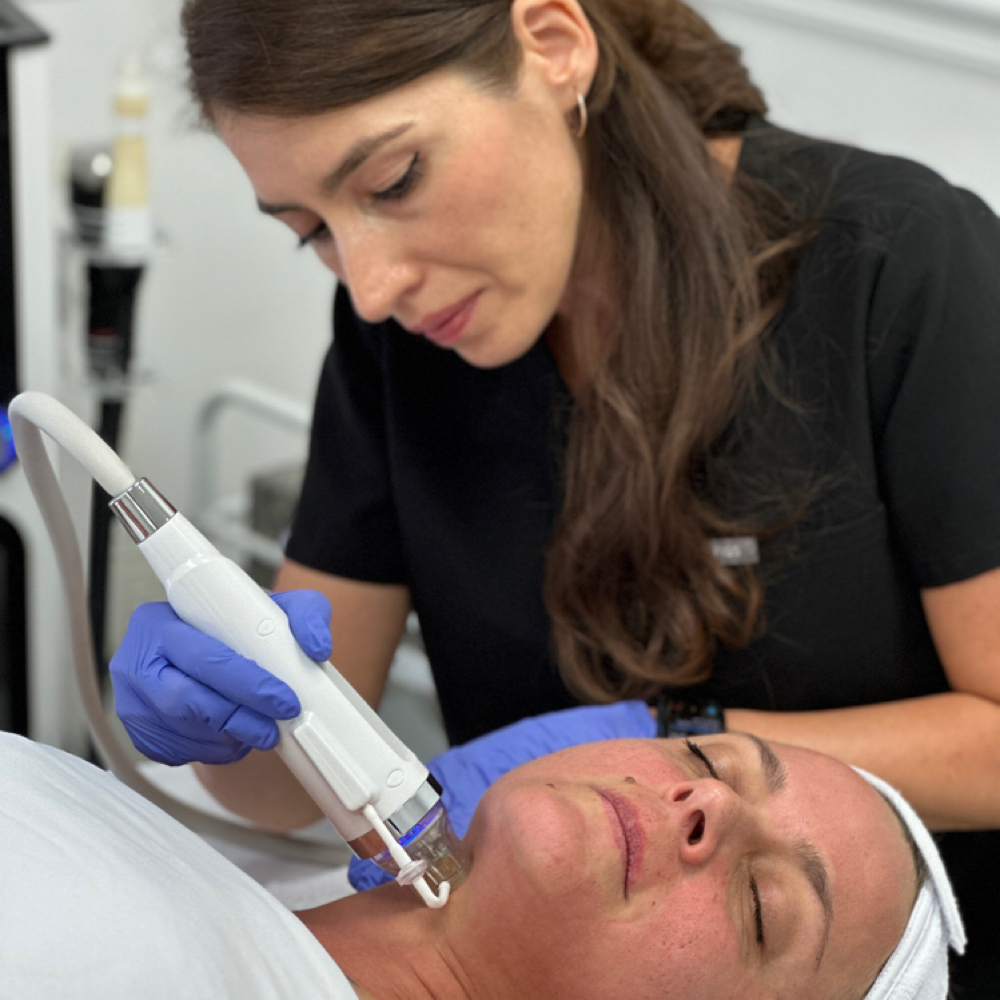 💕RF Microneedling Promotion