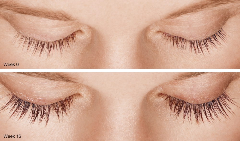 Lash Recovery
