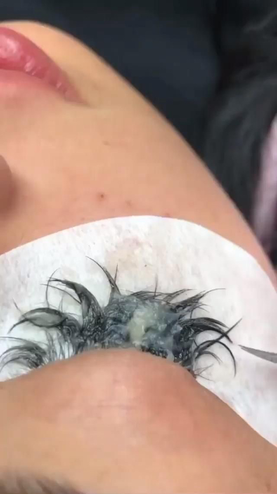Removal