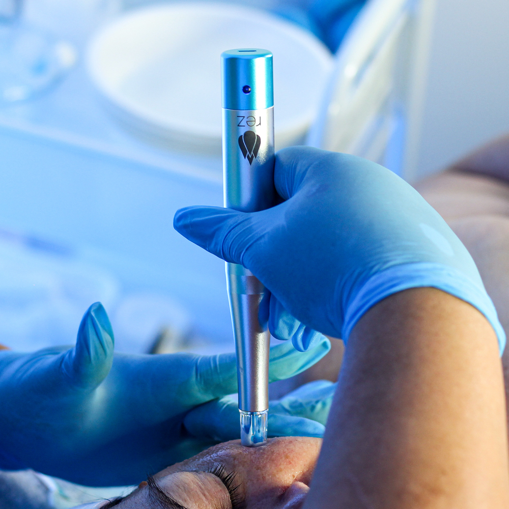 Rezenerate NanoInfusion Facial