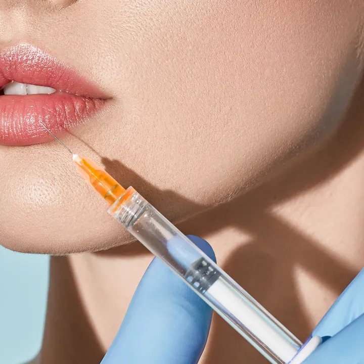 Lip Filler at Chateau  Aesthetics in Brownsville, TX