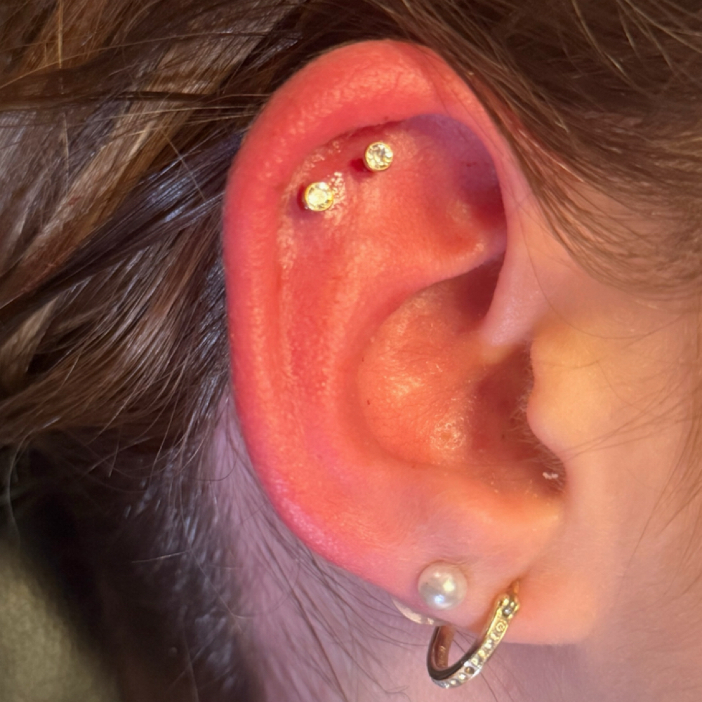 Double Cartilage at The Skin Academy Indy in Indianapolis, IN