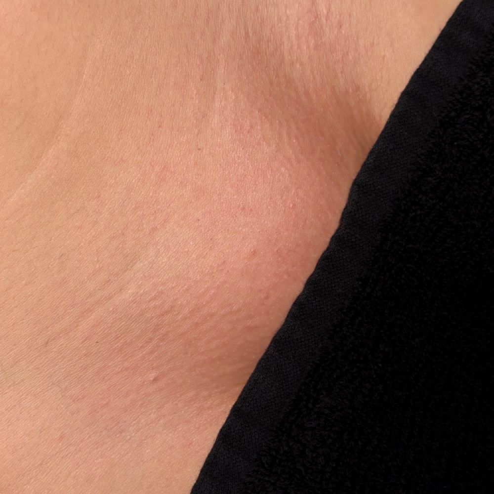 Brazilian Wax at planet HER in Alexandria, IN