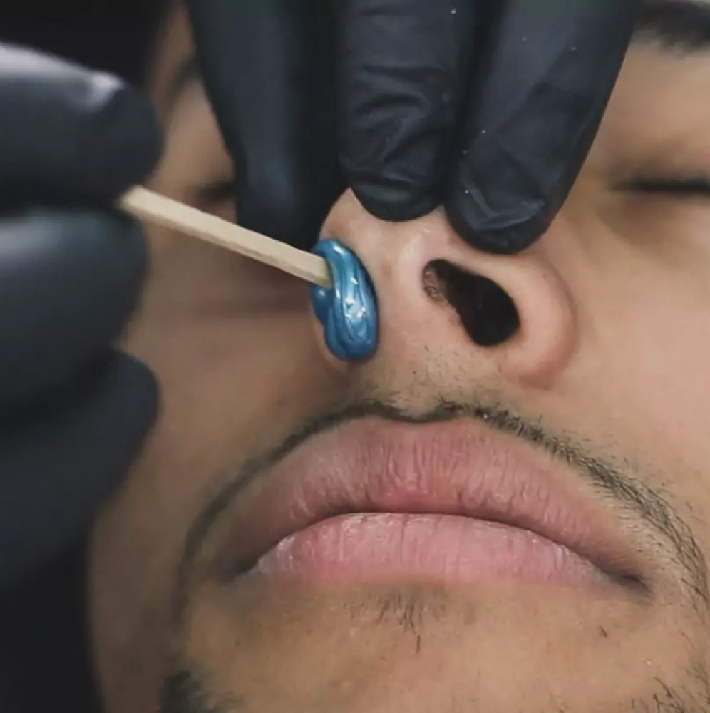 Nose Wax at Illuminate Dentistry & Aesthetics in St. Joseph, MO