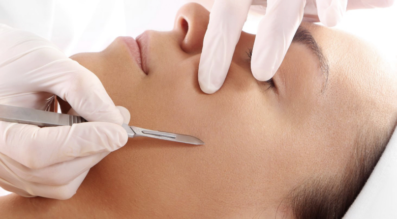 Vellus Hair and Dead Skin Removal