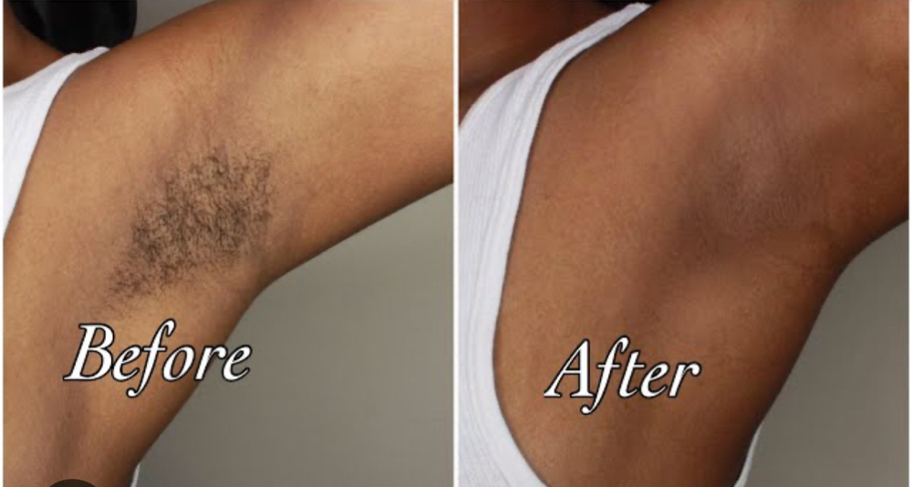 Waxing Armpits