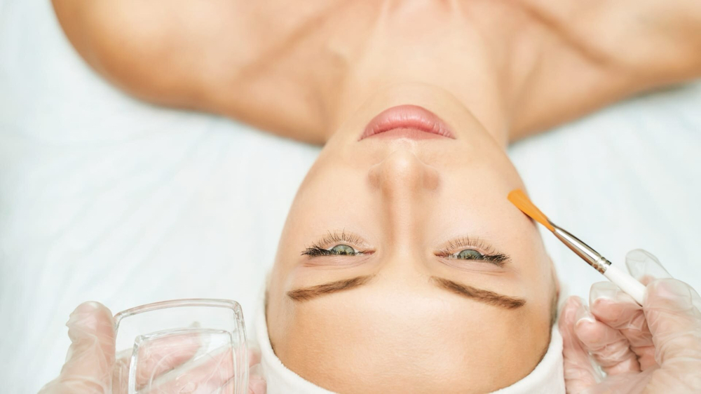Chemical Peel