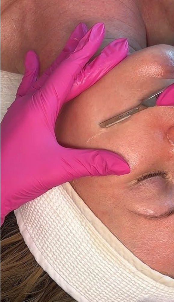 Dermaplaning add-on