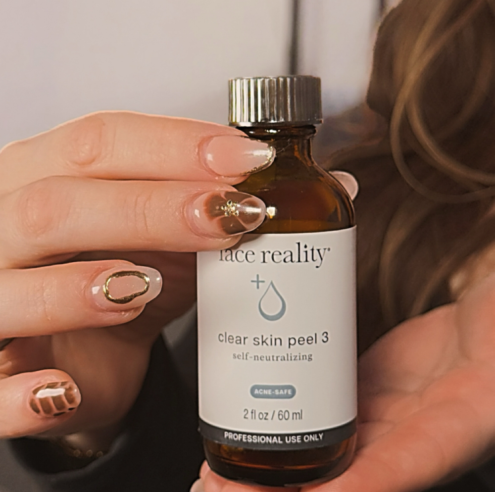 + Chemical Peel at Sunrise Glow Skin in Temple, TX