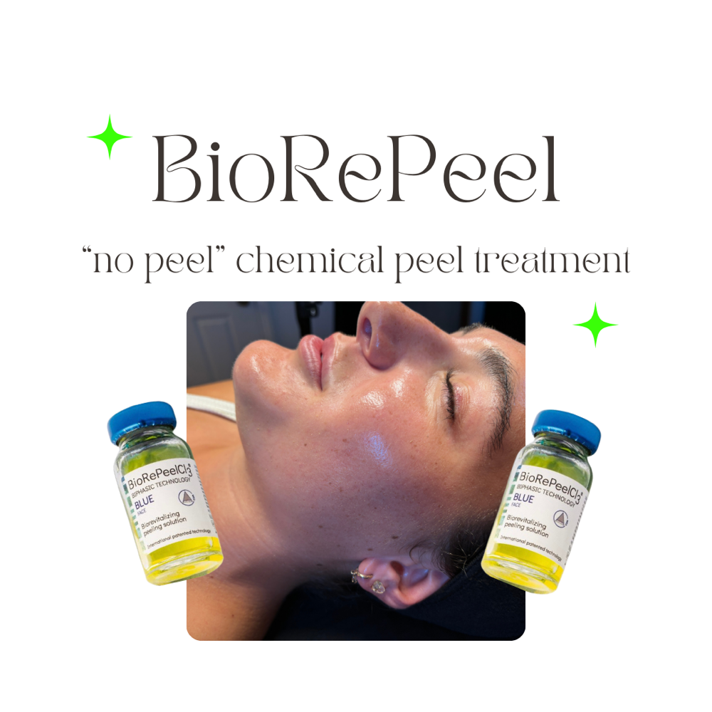 BioRePeel Facial Treatment