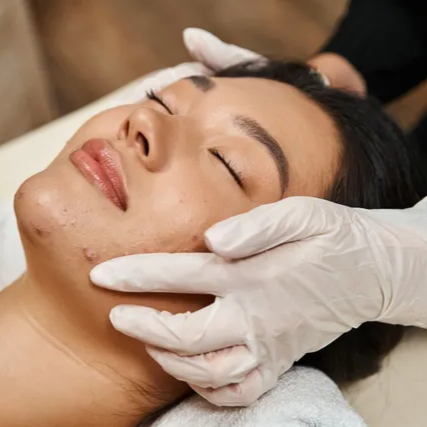 Ance Treatment at JPA Atelier Skin Care, LLC in Charlotte, NC