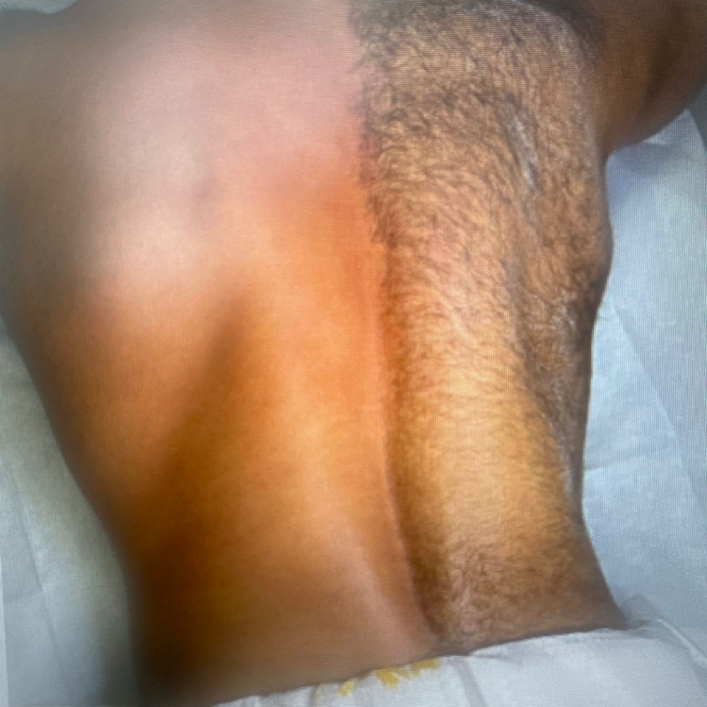 Back Waxing-   1/2 Back at MitzSkin Beauty in Buckeye, AZ