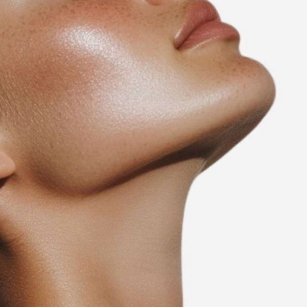 Chemical Peels at Graceful Esthetics in Flower Mound, TX