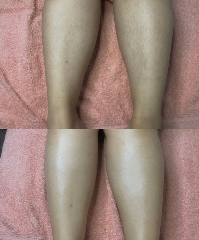 Legs