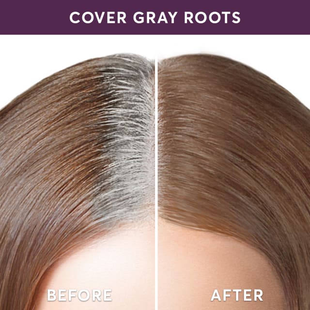 Root Retouch Add On